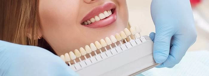 لمینت دندان