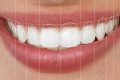 طراحی لبخند دیجیتال