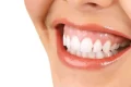 اصلاح لبخند لثه‌ای