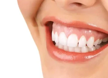 اصلاح لبخند لثه‌ای