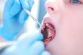عفونت دندان کودکان