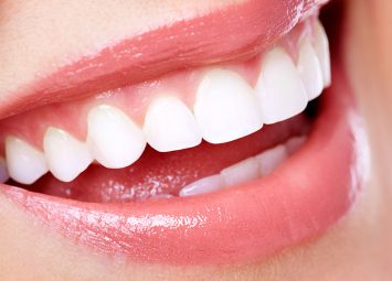 روش های زیباسازی دندان