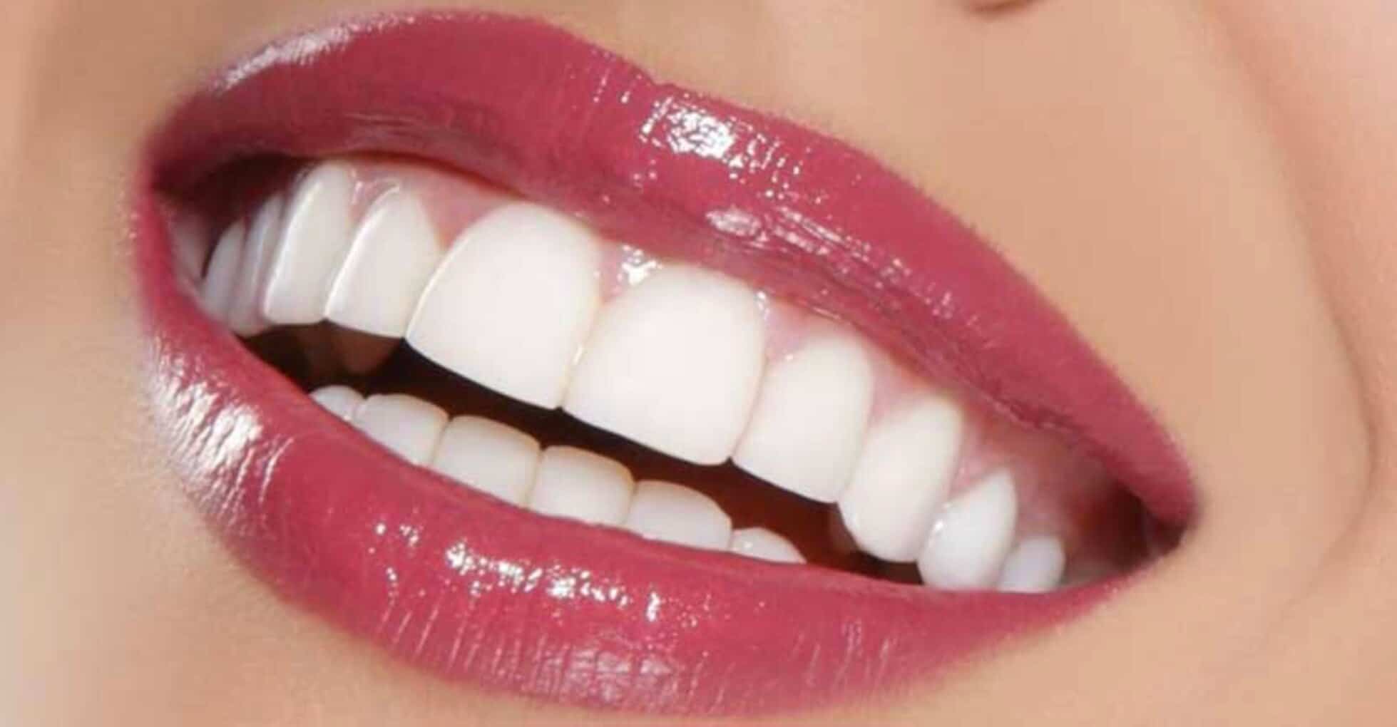 لبخند هالیوودی