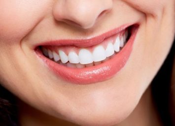 فیس‌ لیفت لبخند