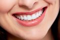 اصلاح طرح لبخند