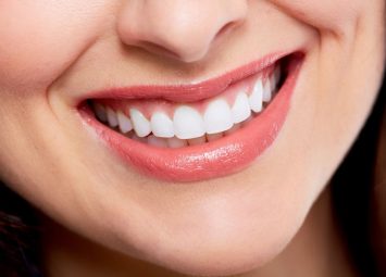 اصلاح طرح لبخند