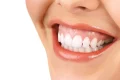 درمان لبخند لثه‌ ای