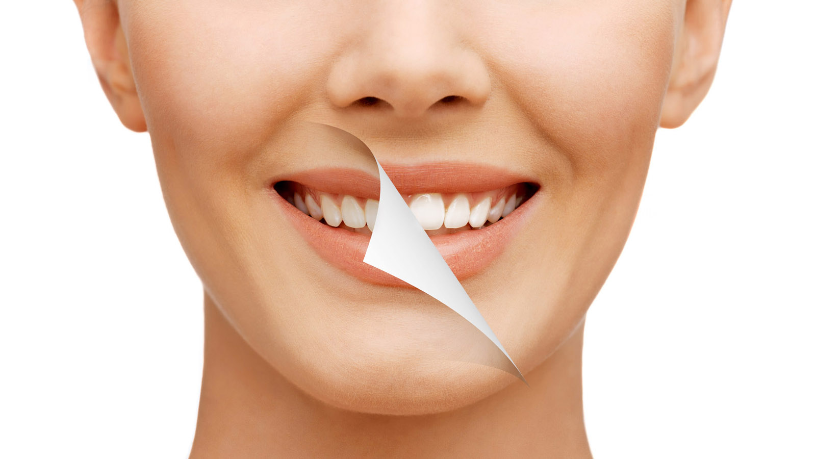 اصلاح طرح لبخند در جیحون