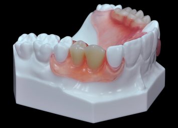 دندان مصنوعی در جیحون