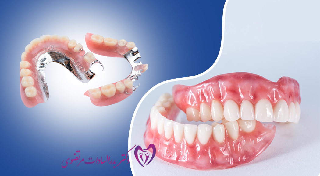 دندان مصنوعی در جیحون