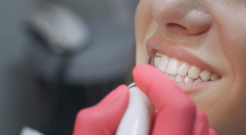 دندانپزشکی زیبایی پیشرفته