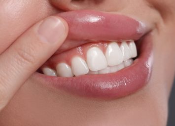 متخصص لثه در جیحون