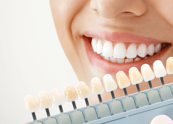 بلیچینگ دندان در منطقه 10