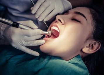 درمان ریشه دندان در منطقه 10