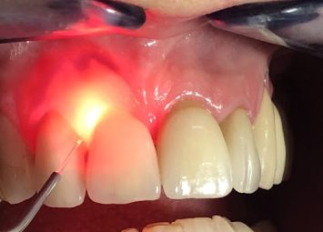 متخصص لثه در جیحون